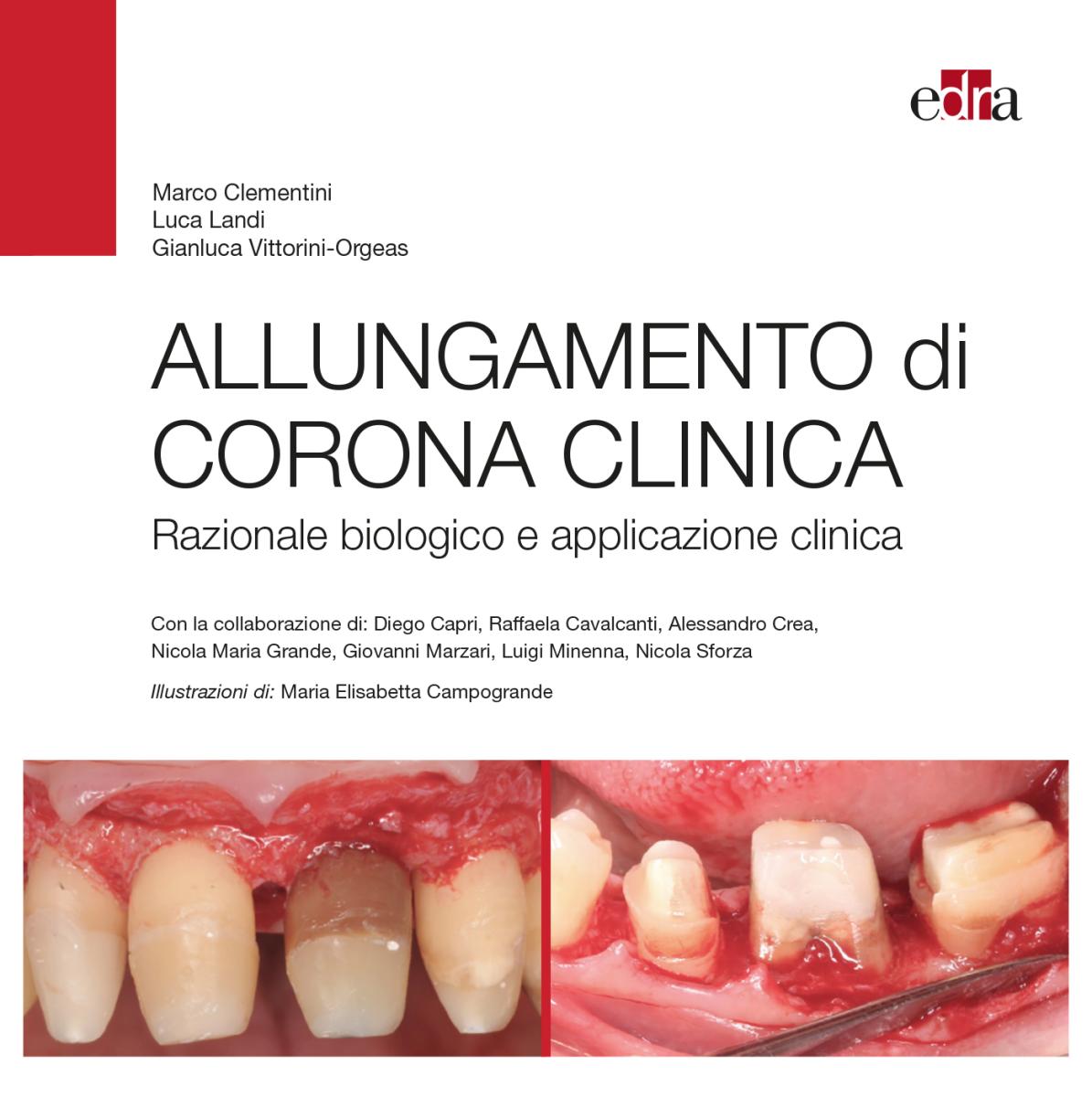 Allungamento corona clinica